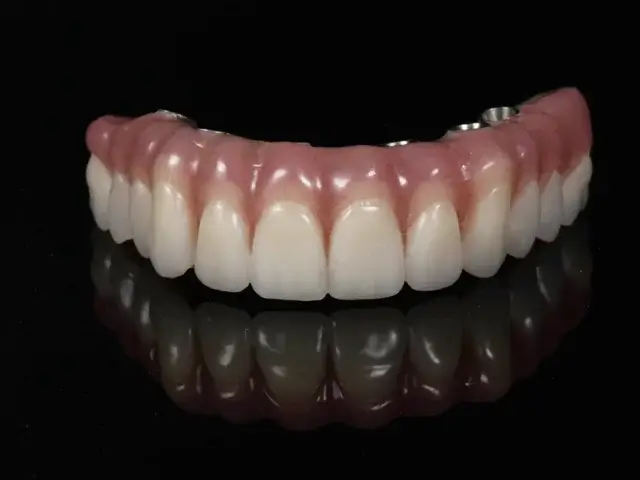 Close-up studio photo of a lifelike full-arch implant-supported zirconia bridge with pink gum tissue and white ceramic teeth, crafted at Dentarts Prosthodontics in Sienna, Missouri City, TX.